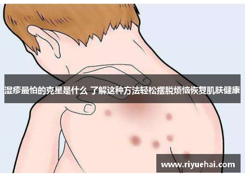 湿疹最怕的克星是什么 了解这种方法轻松摆脱烦恼恢复肌肤健康